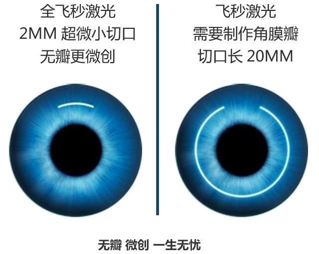 8月20日，北京协和医院李莹教授亲临普瑞眼科医院，为近视